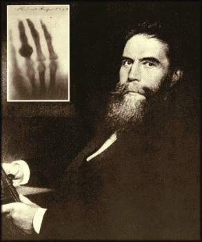 Roentgen
